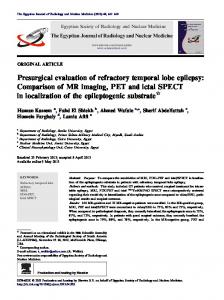 Presurgical evaluation of refractory temporal lobe epilepsy ...