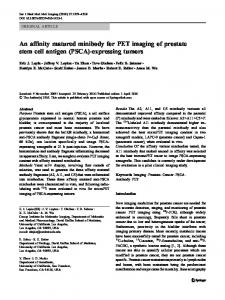 (PSCA)-expressing tumors - Springer Link