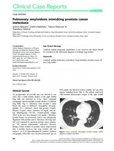 Pulmonary amyloidosis mimicking prostate ... - Wiley Online Library