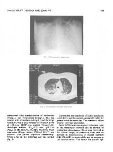 PULMONARY OEDEMA AND