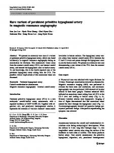 Rare variant of persistent primitive hypoglossal artery ... - Springer Link