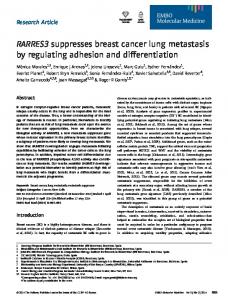 RARRES3 suppresses breast cancer lung