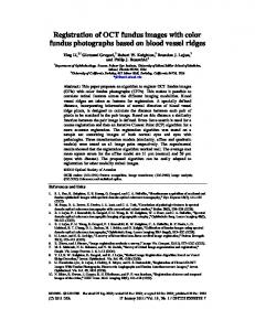 Registration of OCT fundus images with color fundus ... - OSA Publishing