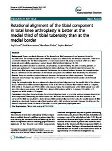 Rotational alignment of the tibial component in total knee arthroplasty