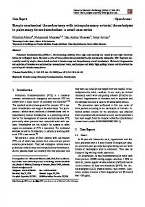 Simple mechanical thrombectomy with