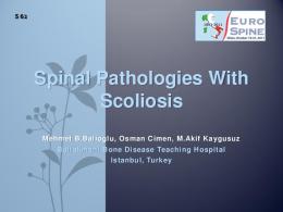 Spinal Pathologies with Scoliosis