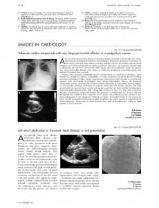 Subacute cardiac tamponade with very large pericardial ... - Heart - BMJ