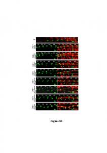 Sup Fig Merabet et al R.ppt .pptx - PLOS