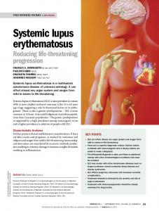 Systemic lupus erythematosus