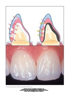 The International Journal of Periodontics & Restorative Dentistry