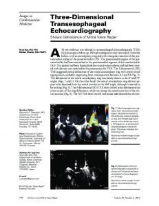 Three-Dimensional Transesophageal Echocardiography