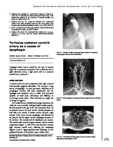 Tortuous common carotid artery as a cause of ... - SAGE Journals