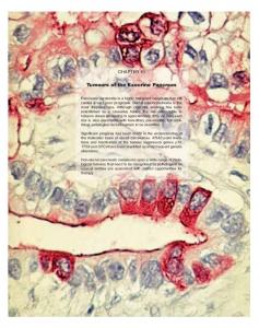 Tumours of the Exocrine Pancreas - IARC