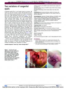 Two variations of congenital epulis