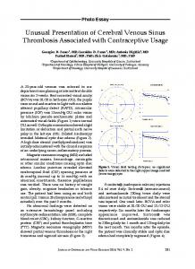 Unusual Presentation of Cerebral Venous Sinus Thrombosis ...