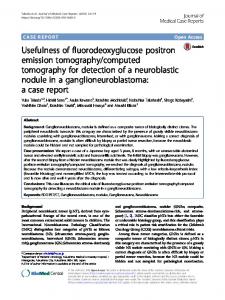 Usefulness of fluorodeoxyglucose positron emission tomography ...