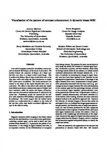 Visualisation of the pattern of contrast enhancement in ... - UQ ITEE