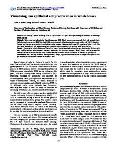 Visualizing lens epithelial cell proliferation in whole ... - Molecular Vision