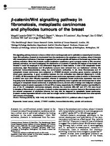 Wnt signalling pathway in fibromatosis, metaplastic ... - Nature